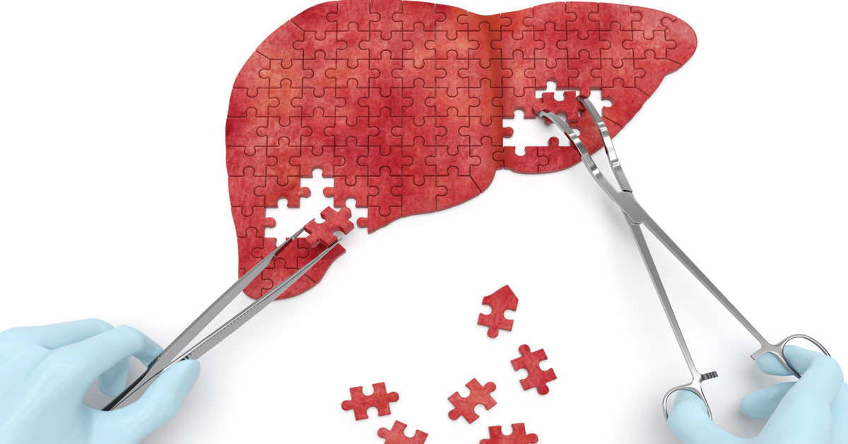 Hay menos casos de Hepatitis A y B a nivel global
