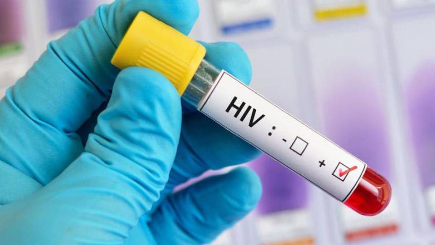Algunos fármacos que se usan para tratar el VIH se están probando contra coronavirus