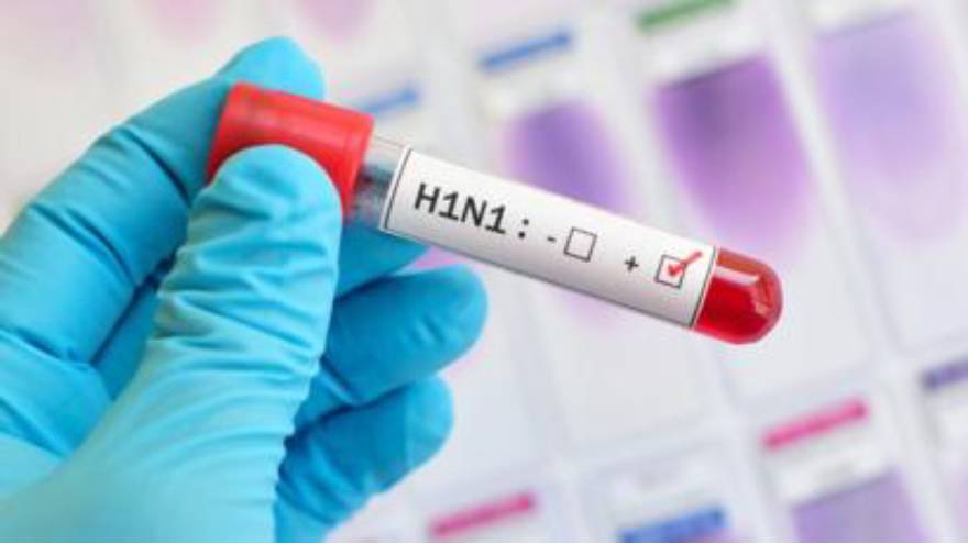 La gripe A H1N1 desencadenó una pandemia en el año 2009