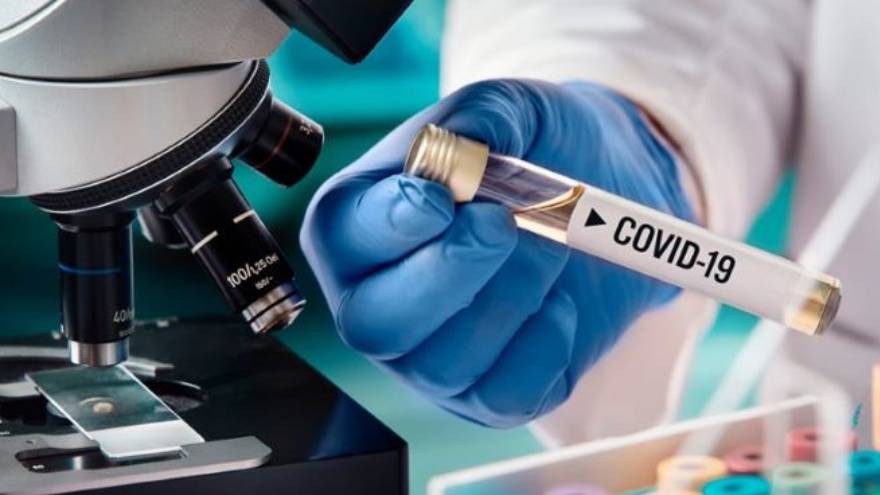 El coronavirus puede sobrevivir en superficies, de acuerdo a algunos estudios