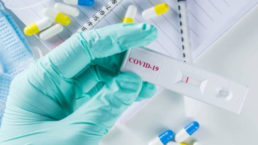 El test de coronavirus sería un requisito para poder obtener el certificado de inmunidad