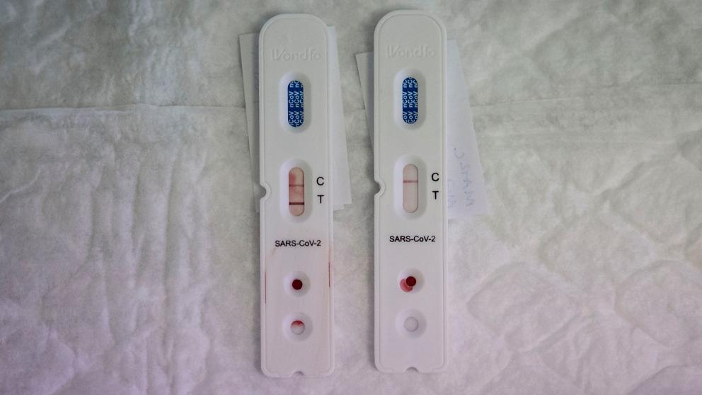 Los test de PCR determinan si la persona tiene coronavirus