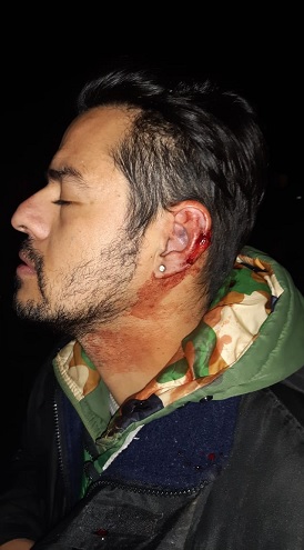 El testimonio de uno de los heridos durante el enfrentamiento