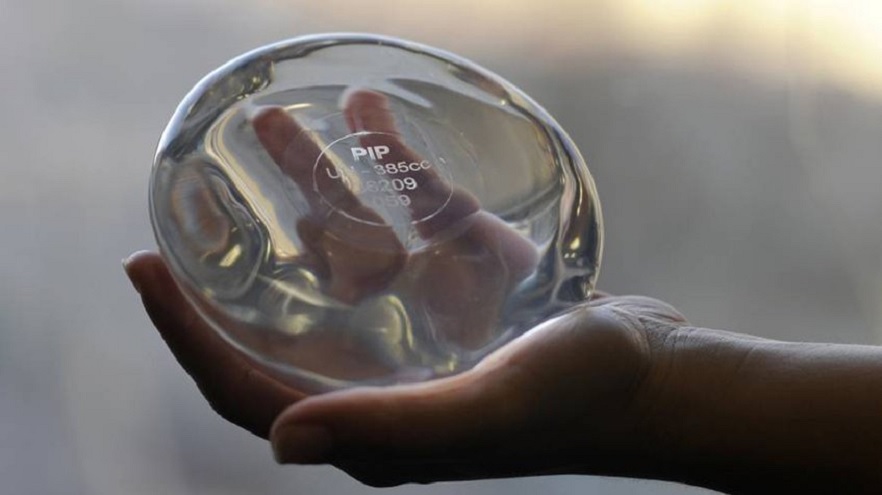 En muchos países del mundo se recomendó la remoción preventiva de los implantes PIP
