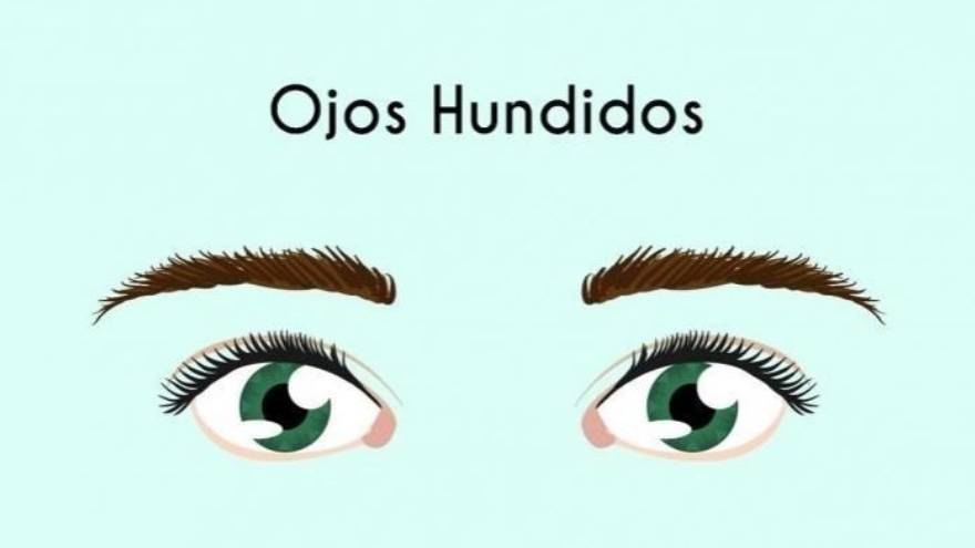 5. Ojos hundidos