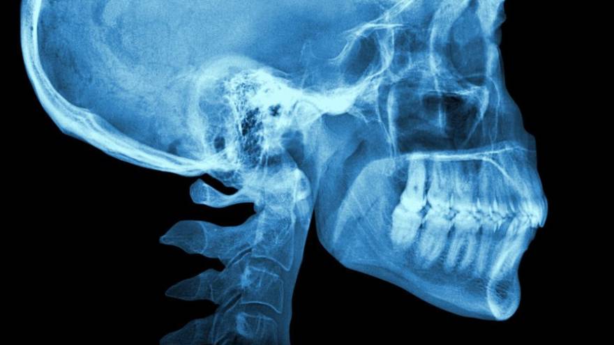 El nuevo órgano se vería en estudios con radioterapia