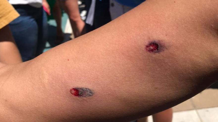 La policía de Gildo Insfrán reprimió a los manifestantes con balas de goma