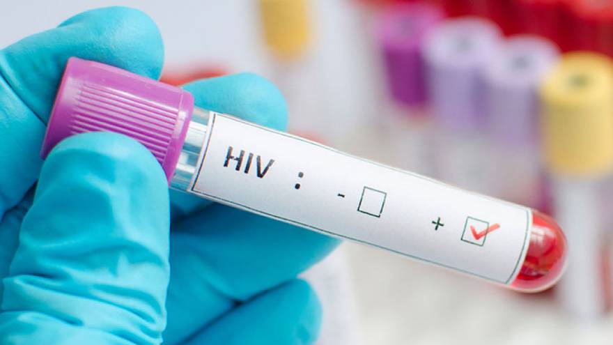 No se podrán hacer test de HIV en los exámenes preocupacionales