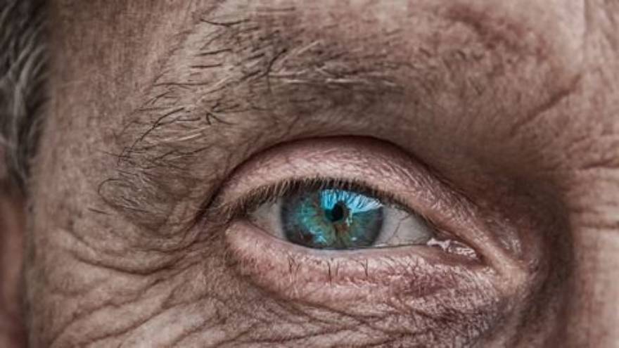 La pérdida de grasa facial es un proceso natural del paso del tiempo y del envejecimiento