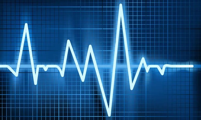 heart-arrhythmia