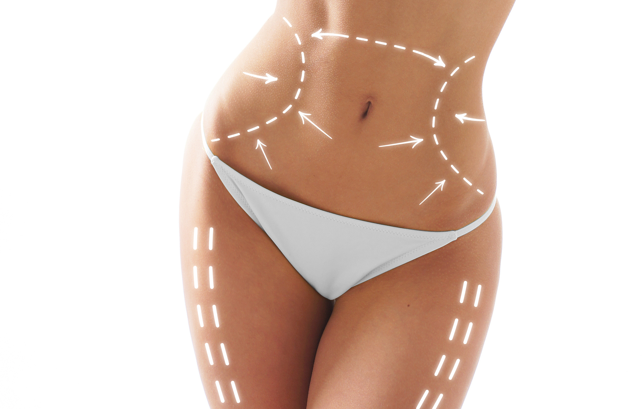 lipo