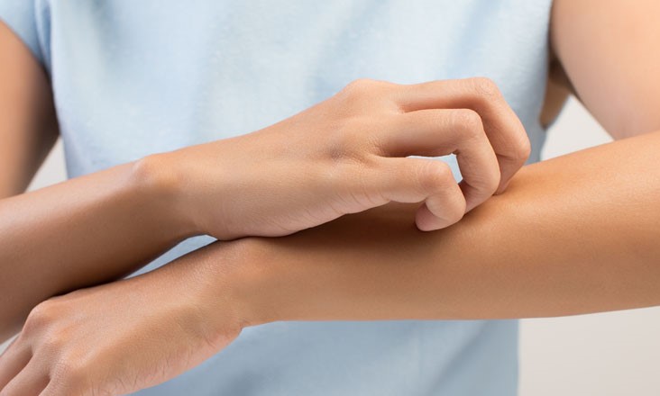 alergiapiel (2)